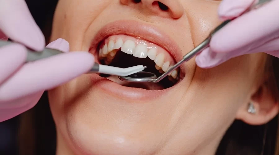 Çerkezköy’de Vidalı Diş (İmplant) Muayenesi Nasıl Yapılır?