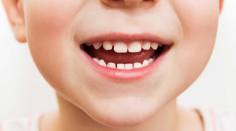 Çocuklarda Diş Hekimi Korkusu